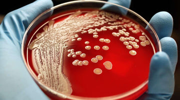 The Importance of Disinfection in the Battle Against MRSA